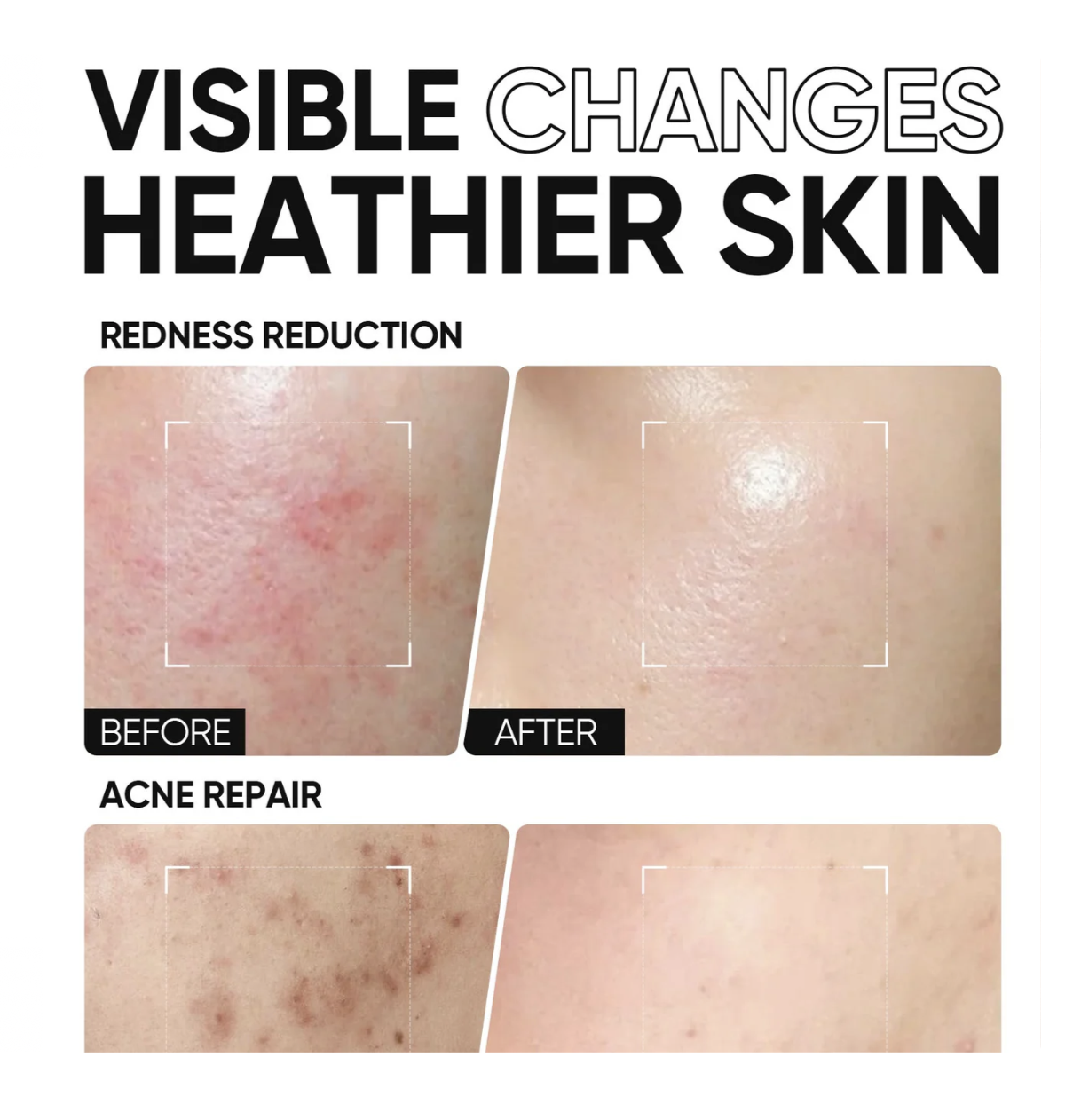 Skintific 5X Ceramide Barrier Moisture Gel (Light Texture) 30g